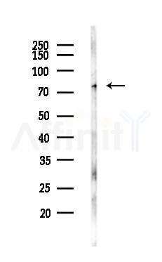 Exo70 Antibody - Western blot analysis of lysates from LoVo cells(heat-shock,45min treatment), using Exo70 Antibody at 1/1000 dilution.