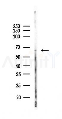 FBXW5 Antibody - Western blot analysis of lysates from PC12 cells(starvation, 24h treatment), using FBXW5 Antibody at 1/1000 dilution.