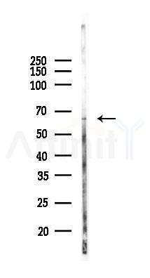 FBXW5 Antibody - Western blot analysis of lysates from K562 cells(UV, 30min treatment), using FBXW5 Antibody at 1/1000 dilution.