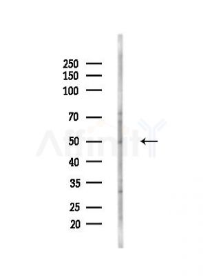 FOXRED1 Antibody - Western blot analysis of lysates from B16F10-LUC cells(heat-shock,45min treatment), using FOXRED1 Antibody at 1/1000 dilution.