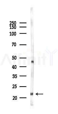 GM2A Antibody - Western blot analysis of lysates from 293 cells(UV,30min treatment), using GM2A Antibody at 1/1000 dilution.