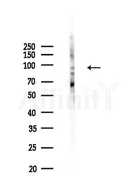HEATR2 Antibody - Western blot analysis of lysates from B16F10-LUC cells(starvation,24h treatment), using HEATR2 Antibody at 1/1000 dilution.