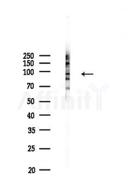 HEATR2 Antibody - Western blot analysis of lysates from COLO205 cells(heat-shock,45min treatment), using HEATR2 Antibody at 1/1000 dilution.