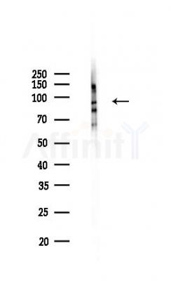 HEATR2 Antibody - Western blot analysis of lysates from HepG2 cells(heat-shock,45min treatment), using HEATR2 Antibody at 1/1000 dilution.