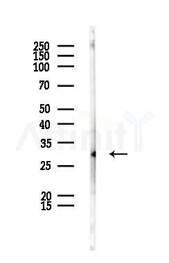 HIST1H1T Antibody - Western blot analysis of lysates from PC12 cells, using HIST1H1T Antibody at 1/1000 dilution.