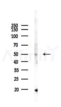 IGSF21 Antibody - Western blot analysis of lysates from 293 cells(UV,30min treatment), using IGSF21 Antibody at 1/1000 dilution.