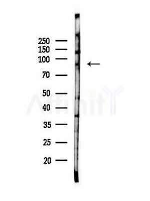 KIF19 Antibody - Western blot analysis of lysates from EC304 cells(heat-shock,45min treatment), using KIF19 Antibody at 1/1000 dilution.
