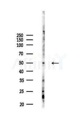 KLF10 Antibody - Western blot analysis of lysates from COLO205 cells(heat-shock,45min treatment), using KLF10 Antibody at 1/1000 dilution.
