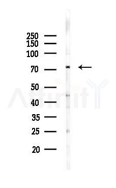 Kv1.4 Antibody - Western blot analysis of lysates from HepG2 cells(starvation,24h treatment), using Kv1.
