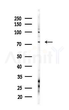 Kv1.4 Antibody - Western blot analysis of lysates from COLO205 cells(heat-shock,45min treatment), using Kv1.