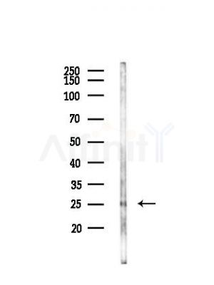LIN7C Antibody - Western blot analysis of lysates from LoVo cells(heat-shock,45min treatment), using LIN7C Antibody at 1/1000 dilution.