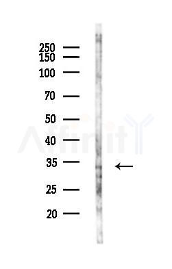 MDH2 Antibody - Western blot analysis of lysates from LoVo cells(heat-shock,45min treatment), using MDH2 Antibody at 1/1000 dilution.