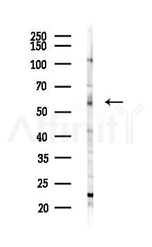 MEIS2 Antibody - Western blot analysis of lysates from Mouse liver, using MEIS2 Antibody at 1/1000 dilution.