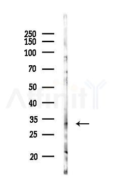 METTL6 Antibody - Western blot analysis of lysates from COLO205 cells(heat-shock,45min treatment), using METTL6 Antibody at 1/1000 dilution.