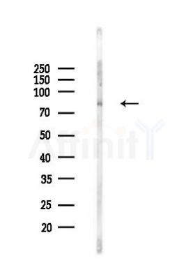MIPEP Antibody - Western blot analysis of lysates from Rat brain, using MIPEP Antibody at 1/1000 dilution.
