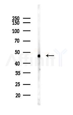 MLN64 Antibody - Western blot analysis of lysates from Mouse liver, using MLN64 Antibody at 1/1000 dilution.