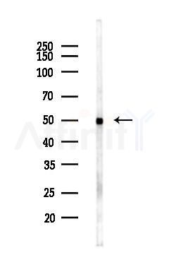MLN64 Antibody - Western blot analysis of lysates from LoVo cells(heat-shock,45min treatment), using MLN64 Antibody at 1/1000 dilution.