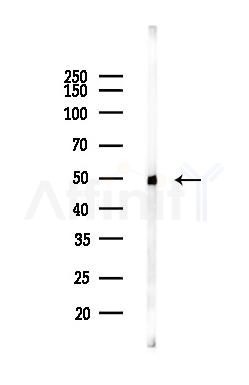 MLN64 Antibody - Western blot analysis of lysates from COLO205 cells(LPS,4h treatment), using MLN64 Antibody at 1/1000 dilution.
