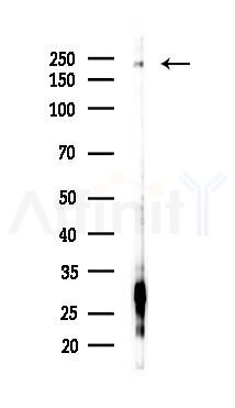 MYH10 Antibody - Western blot analysis of lysates from COLO205 cells(heat-shock,45min treatment), using MYH10 Antibody at 1/1000 dilution.