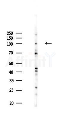 MYO1D Antibody - Western blot analysis of lysates from Hela cells(LPS,4h treatment), using MYO1D Antibody at 1/1000 dilution.