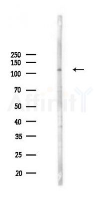 MYO1D Antibody - Western blot analysis of lysates from PC12 cells(starvation,24h treatment), using MYO1D Antibody at 1/1000 dilution.