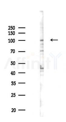 MYO1D Antibody - Western blot analysis of lysates from EC304 cells(UV,30min treatment), using MYO1D Antibody at 1/1000 dilution.