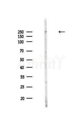 Myoferlin Antibody - Western blot analysis of lysates from MDA-MB-231 cells(heat-shock,45min treatment), using Myoferlin Antibody at 1/1000 dilution.