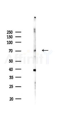 NR1D2 Antibody - Western blot analysis of lysates from Hela cells(LPS,4h treatment), using NR1D2 Antibody at 1/1000 dilution.