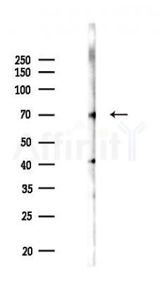 NR1D2 Antibody - Western blot analysis of lysates from EC304 cells(UV,30min treatment), using NR1D2 Antibody at 1/1000 dilution.