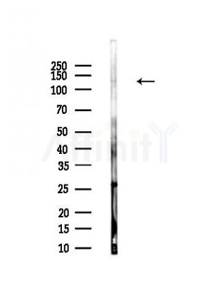 NRCAM Antibody - Western blot analysis of lysates from Rat brain, using NRCAM Antibody at 1/1000 dilution.