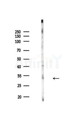 NUS1 Antibody - Western blot analysis of lysates from MDA-MB-231 cells(heat-shock,45min treatment), using NUS1 Antibody at 1/1000 dilution.