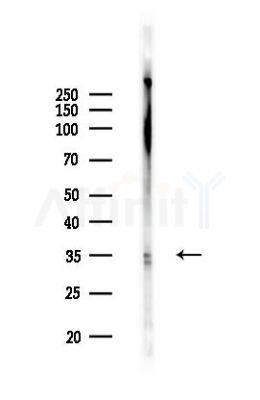 SC35 Antibody - Western blot analysis of lysates from B16F10-LUC cells(UV,30min treatment), using SC35 Antibody at 1/1000 dilution.