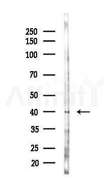 GJB6 Antibody - Western blot analysis of lysates from COLO205 cells(heat-shock,45min treatment), using GJB6 Antibody at 1/1000 dilution.