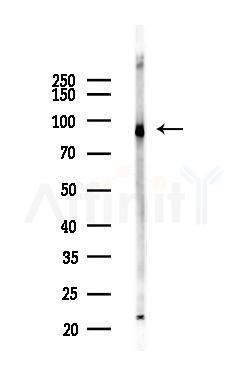 ALDH1L1 Antibody - Western blot analysis of lysates from Mouse liver, using ALDH1L1 Antibody at 1/1000 dilution.