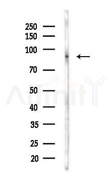 Furin Antibody - Western blot analysis of lysates from COLO205 cells(heat-shock,45min treatment), using Furin Antibody at 1/1000 dilution.