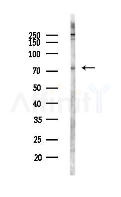 Kv4.3 Antibody - Western blot analysis of lysates from LoVo cells(heat-shock,45min treatment), using Kv4.