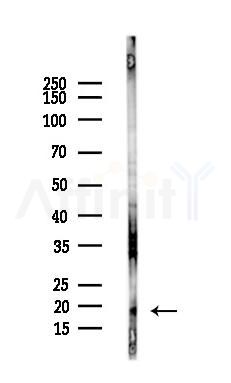Somatostatin Antibody - Western blot analysis of lysates from COLO205 cells(LPS,4h treatment), using Somatostatin Antibody at 1/1000 dilution.