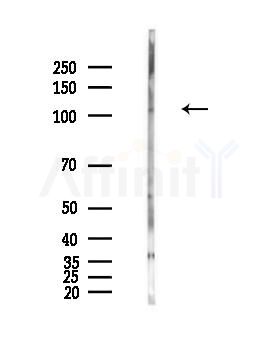 TRPC4 Antibody - Western blot analysis of lysates from PC12 cells(LPS,4h treatment), using TRPC4 Antibody at 1/1000 dilution.
