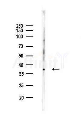 cbx7 Antibody - Western blot analysis of lysates from K562 cells(UV,30min treatment), using cbx7 Antibody at 1/1000 dilution.