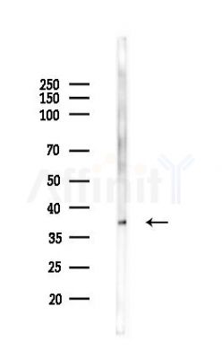 cbx7 Antibody - Western blot analysis of lysates from Mouse testis, using cbx7 Antibody at 1/1000 dilution.