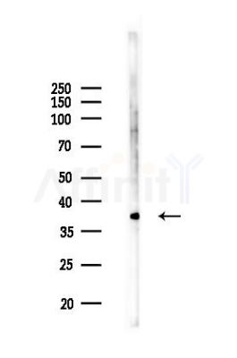 cbx7 Antibody - Western blot analysis of lysates from B16F10-LUC cells(UV,30min treatment), using cbx7 Antibody at 1/1000 dilution.
