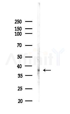 VPS26 Antibody - Western blot analysis of lysates from LoVo cells(heat-shock,45min treatment), using VPS26 Antibody at 1/1000 dilution.