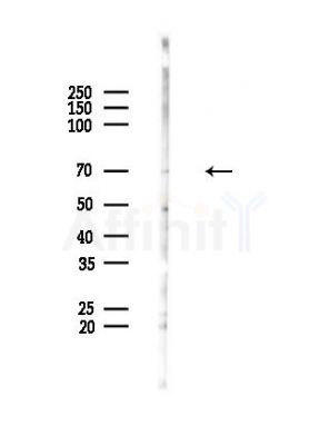Cytoplasmic dynein 1 intermediate chain 1 Antibody - Western blot analysis of lysates from HUVEC cells(LPS,4h treatment), using Cytoplasmic dynein 1 intermediate chain 1 Antibody at 1/1000 dilution.