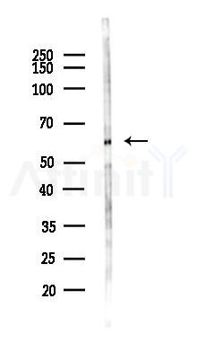 Lgi1 Antibody - Western blot analysis of lysates from HUVEC cells(LPS,4h treatment), using Lgi1 Antibody at 1/1000 dilution.
