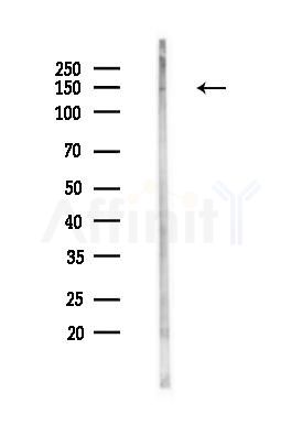 KMT1E / SETDB1 Antibody - Western blot analysis of lysates from Mouse testis, using KMT1E / SETDB1 Antibody at 1/1000 dilution.