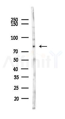 MTA2 Antibody - Western blot analysis of lysates from HUVEC cells(LPS,4h treatment), using MTA2 Antibody at 1/1000 dilution.