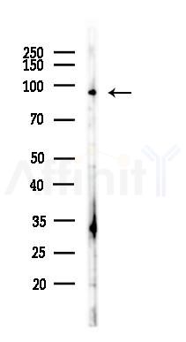 CD62P Antibody - Western blot analysis of lysates from HUVEC cells(LPS,4h treatment), using CD62P Antibody at 1/1000 dilution.