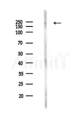 CHD4 Antibody - Western blot analysis of lysates from HUVEC cells(LPS,4h treatment), using CHD4 Antibody at 1/1000 dilution.