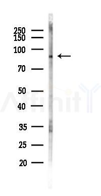 PRDM16 Antibody - Western blot analysis of lysates from HUVEC cells(LPS,4h treatment), using PRDM16 Antibody at 1/1000 dilution.