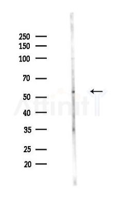 FKBP51 Antibody - Western blot analysis of lysates from PC12 cells(UV,30min treatment), using FKBP51 Antibody at 1/1000 dilution.